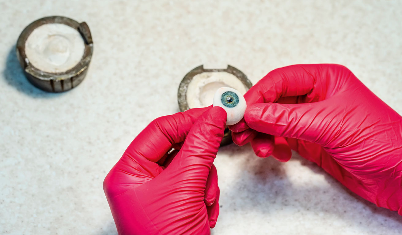 Foto: Hände in Handschuhen halten eine Augenprothese.
